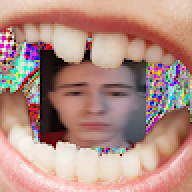 SAU